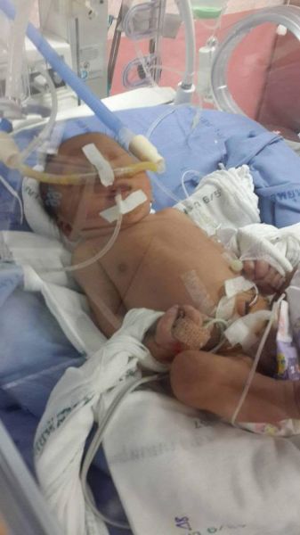 Help My Brother's 5 Months Old Baby To Survive